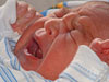 Prematur fødsel eller røyking hos foreldre øker risiko for ørebetennelse